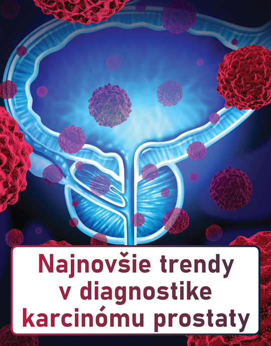 Najnovšie trendy v diagnostike karcinómu prostaty